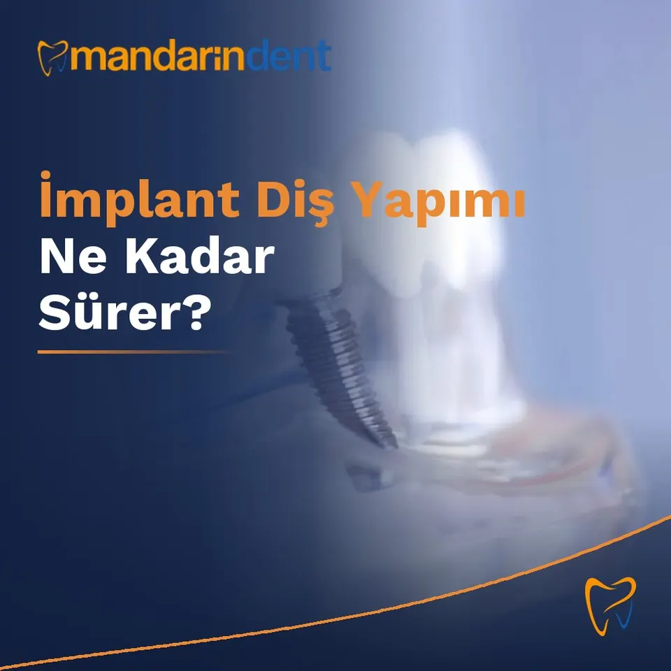 İmplant Diş Yapımı Ne Kadar Sürer?