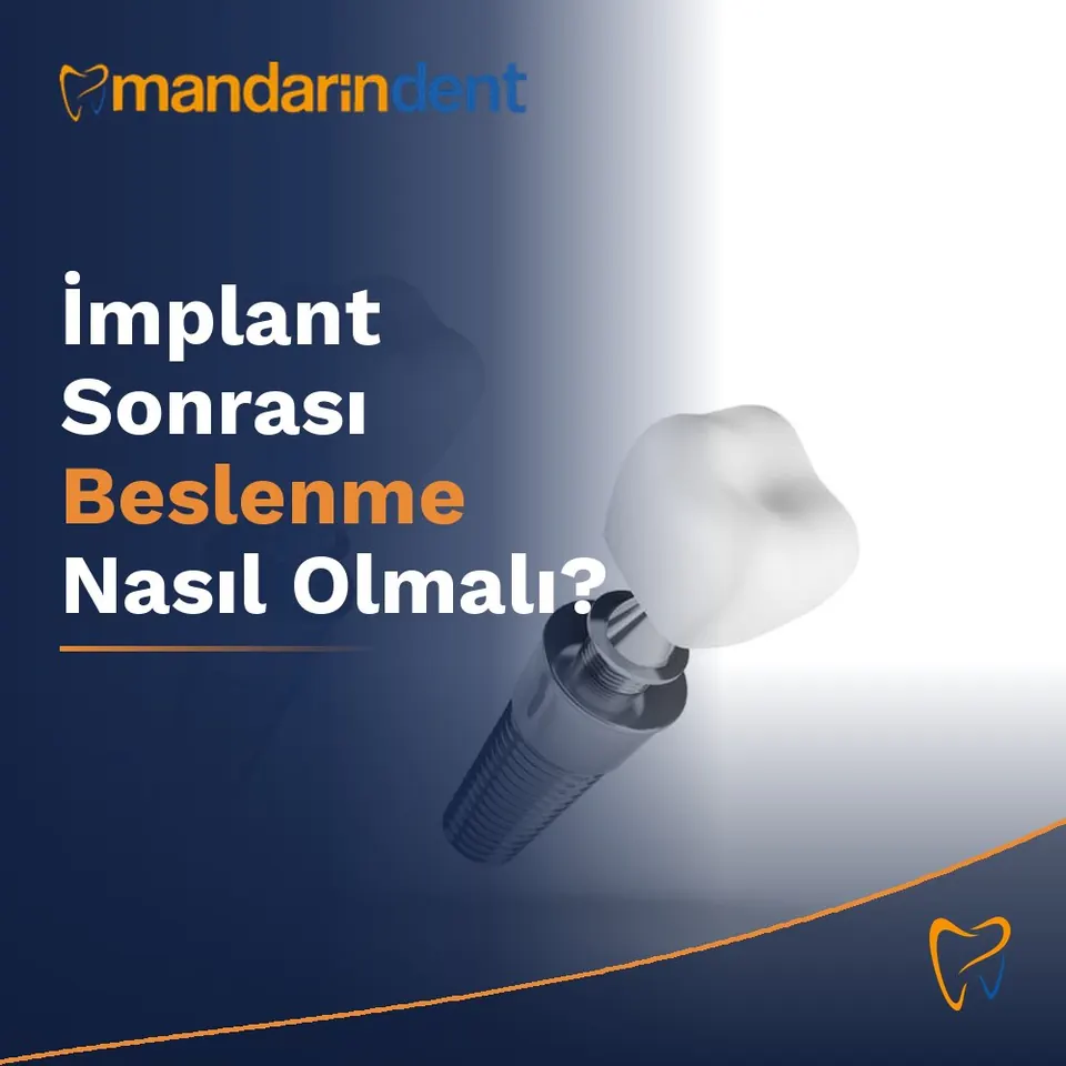 İmplant Sonrası Beslenme Nasıl Olmalı?