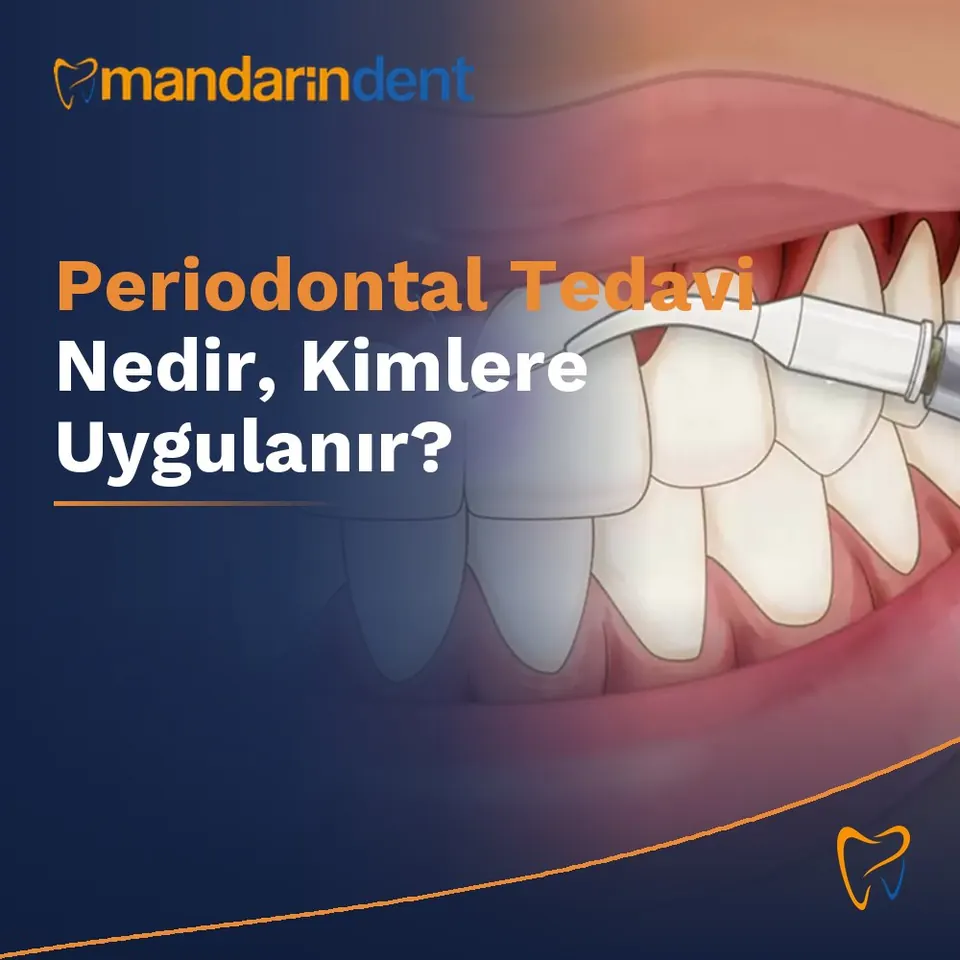 Periodontal Tedavi Nedir, Kimlere Uygulanır?