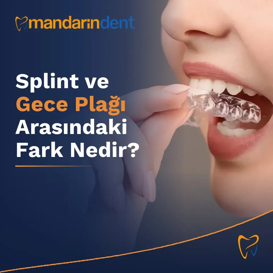 Splint ve Gece Plağı Arasındaki Fark Nedir?