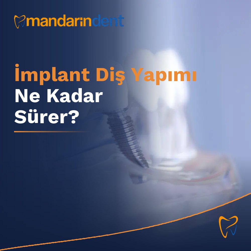 İmplant Diş Yapımı Ne Kadar Sürer?