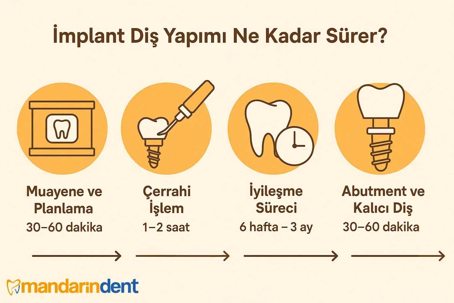 implant ne kadar sürer-Komple implant Ne Kadar Sürer