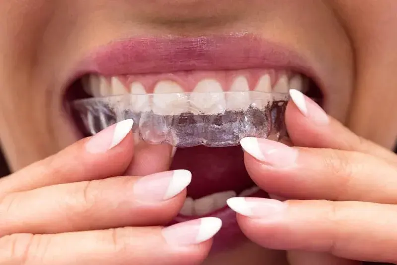 Bodrum Şeffaf Plaklar (Invisalign)