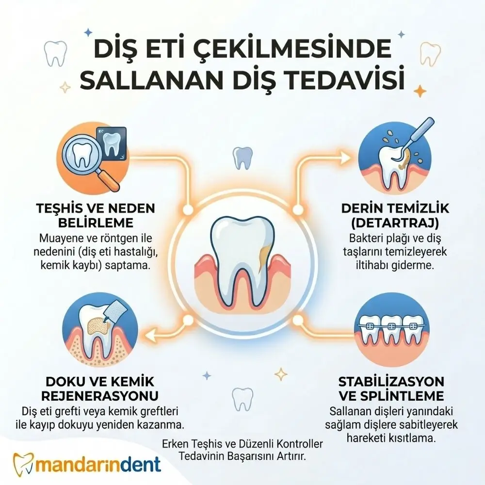 sallanan diş tedavisi nasıl olur