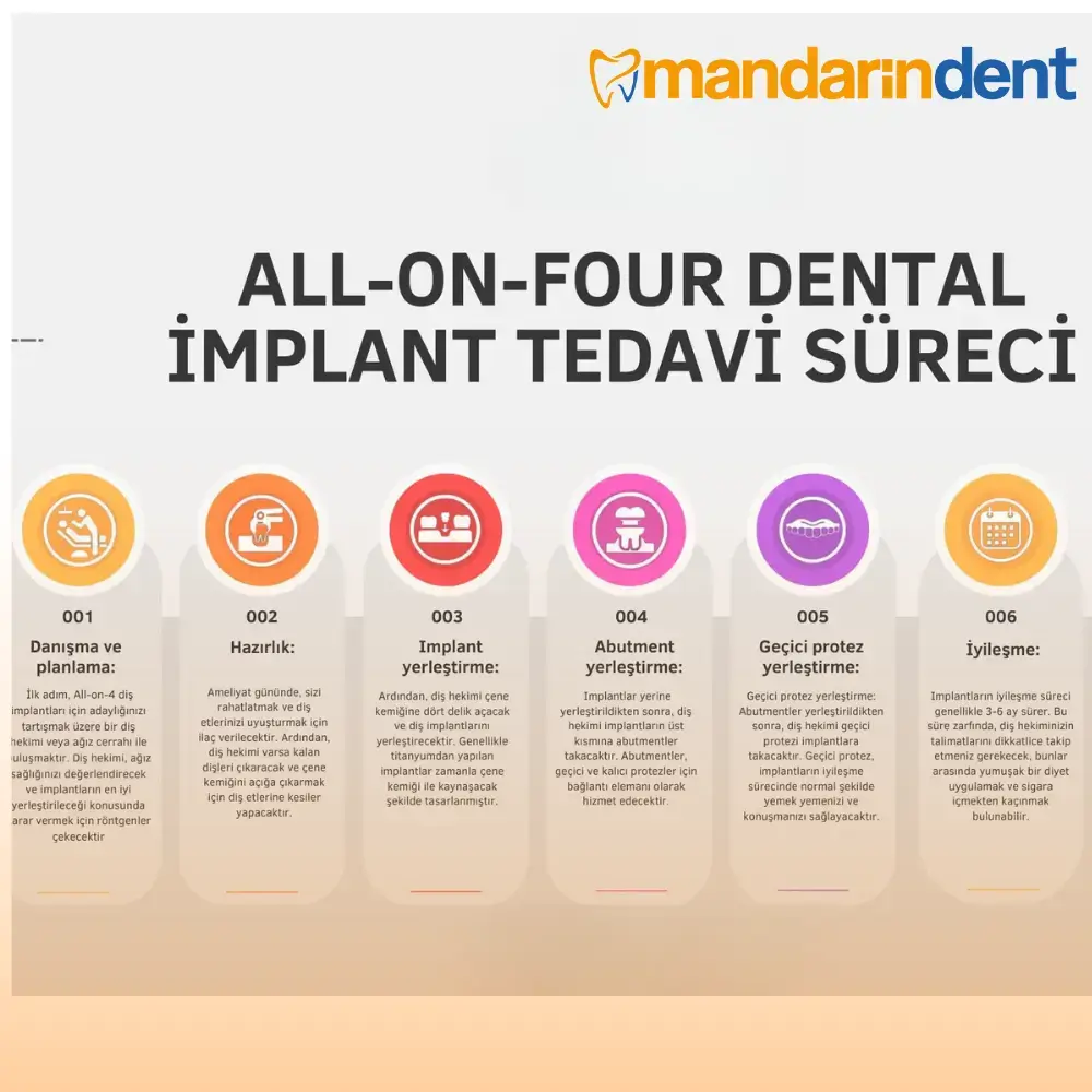 Bodrum All on Four Dental İmplant Tedavisi, Bodrum En İyi Diş İmplant Kliniği,  Bodrum 
all on 4 dental implants