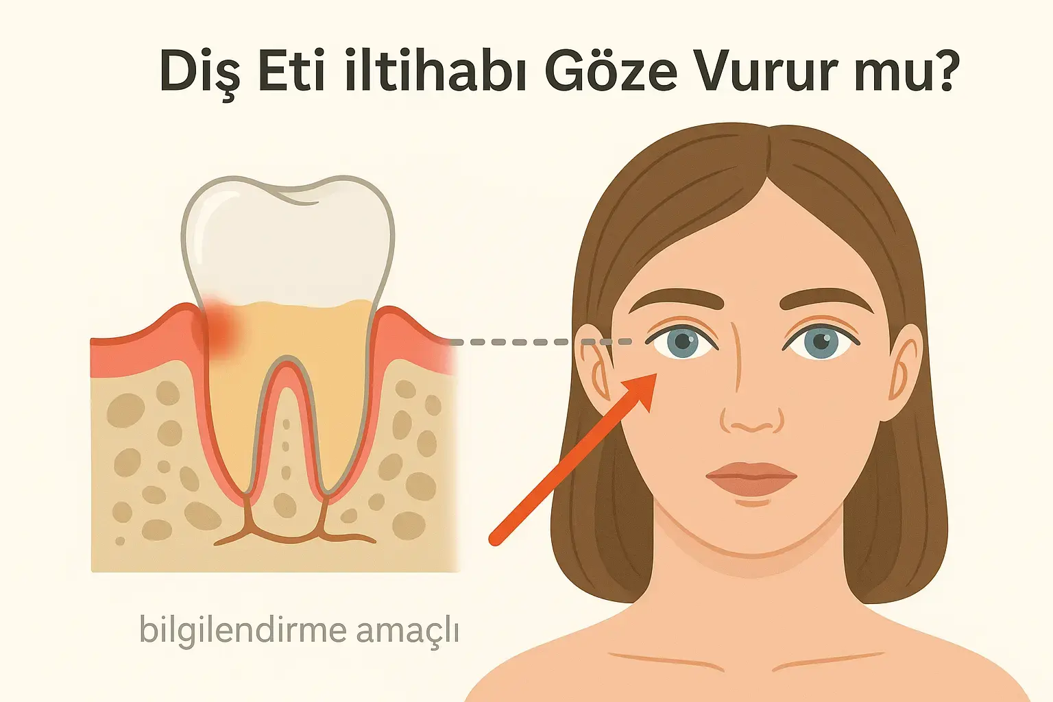 Diş Eti İltihabı Göze Vurur mu
