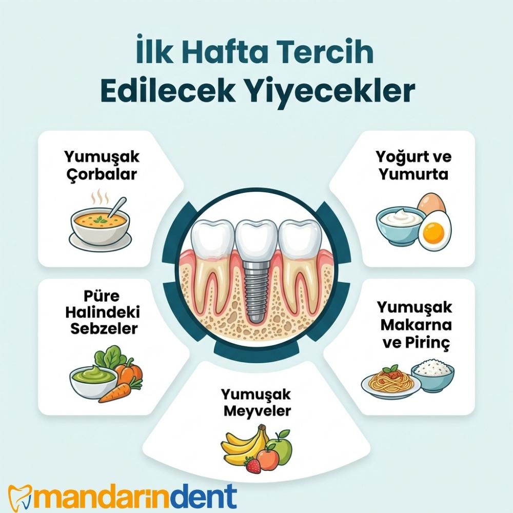 implant sonrası nasıl beslenmeli