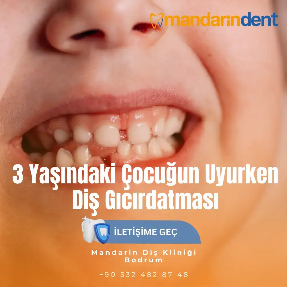 3 Yaşındaki Çocuğun Uyurken Diş Gıcırdatması