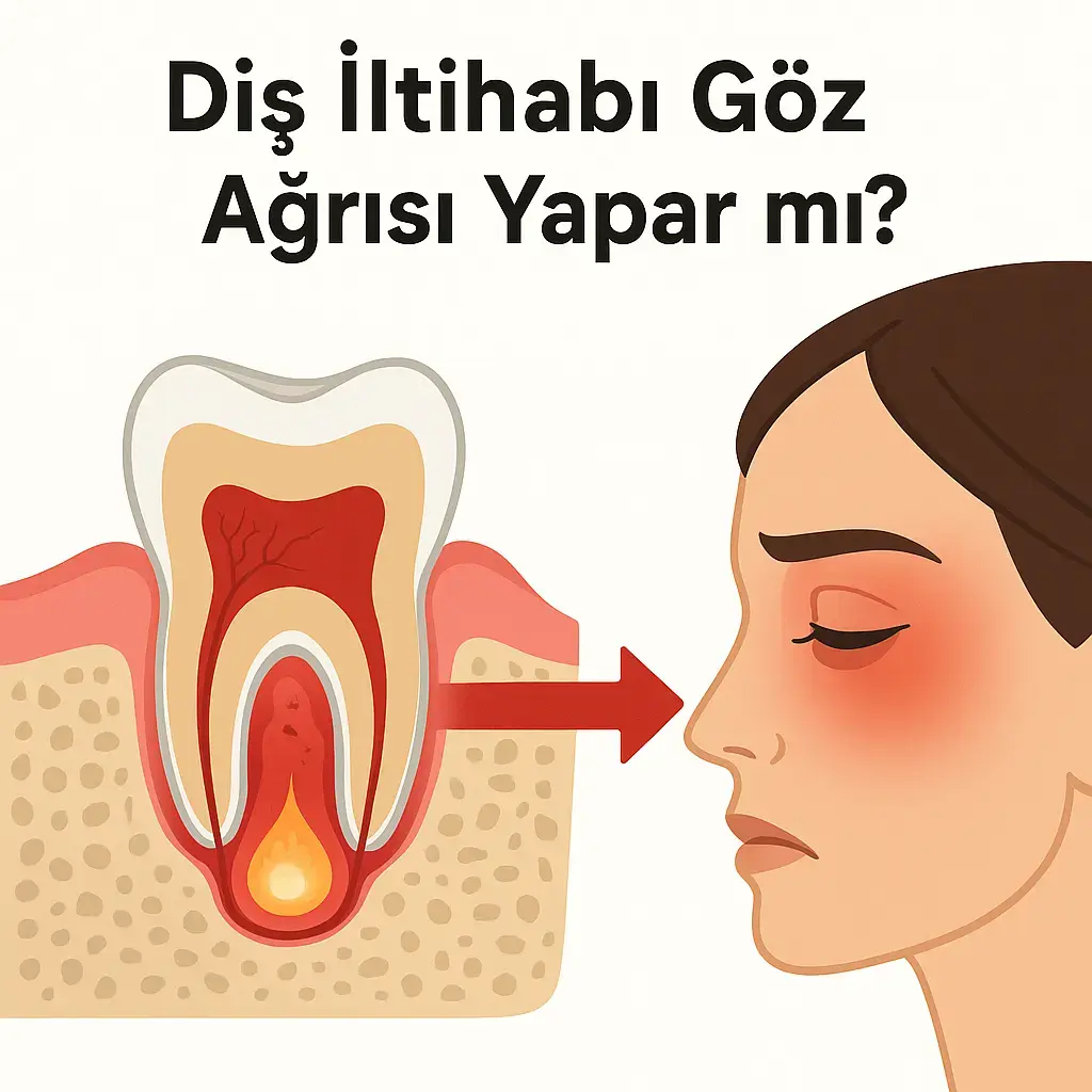 Diş İltihabı Göz Ağrısı Yapar mı