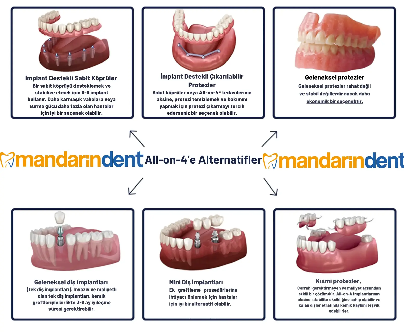 Bodrum All on Four (4 İmplant Sabit Protez) Tedavisi, Bodrum En İyi Diş İmplant Kliniği,  Bodrum 
all on 4 dental implants