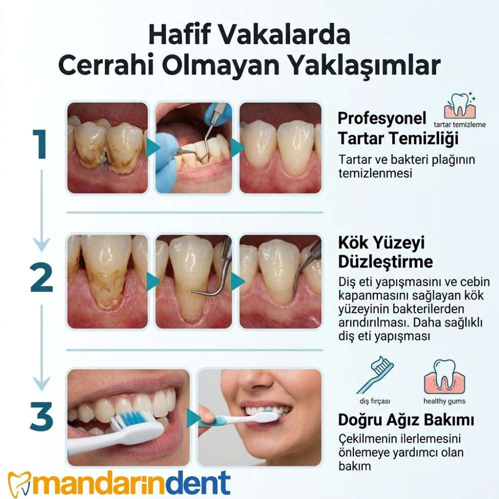 Diş eti grefti kaç günde iyileşir?