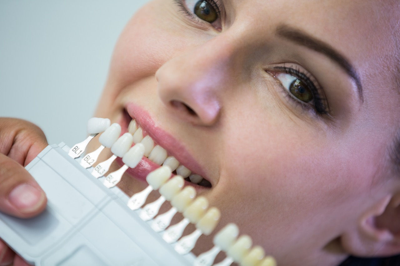 Porcelain veneers in Bodrum, Turkey