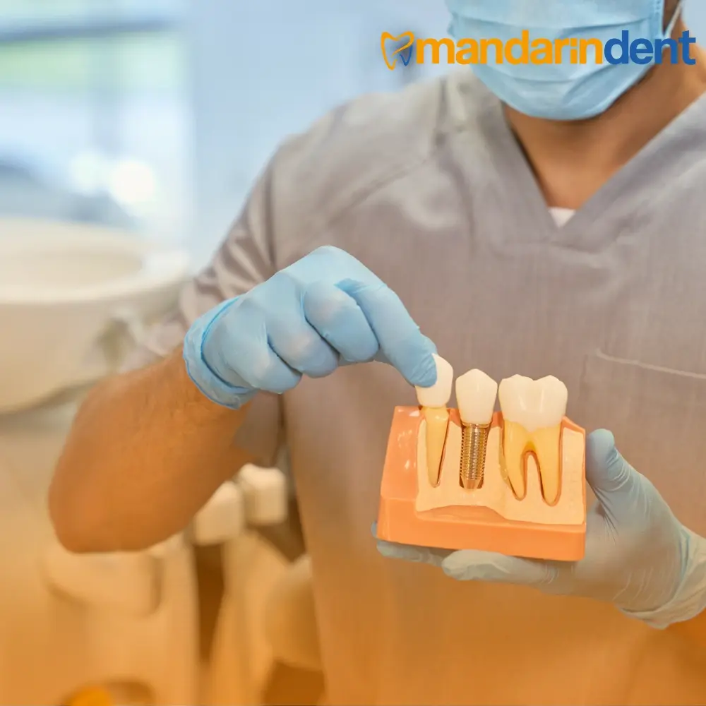Bodrum All on Four Dental İmplant Tedavisi, Bodrum En İyi Diş İmplant Kliniği,  Bodrum 
all on 4 dental implants